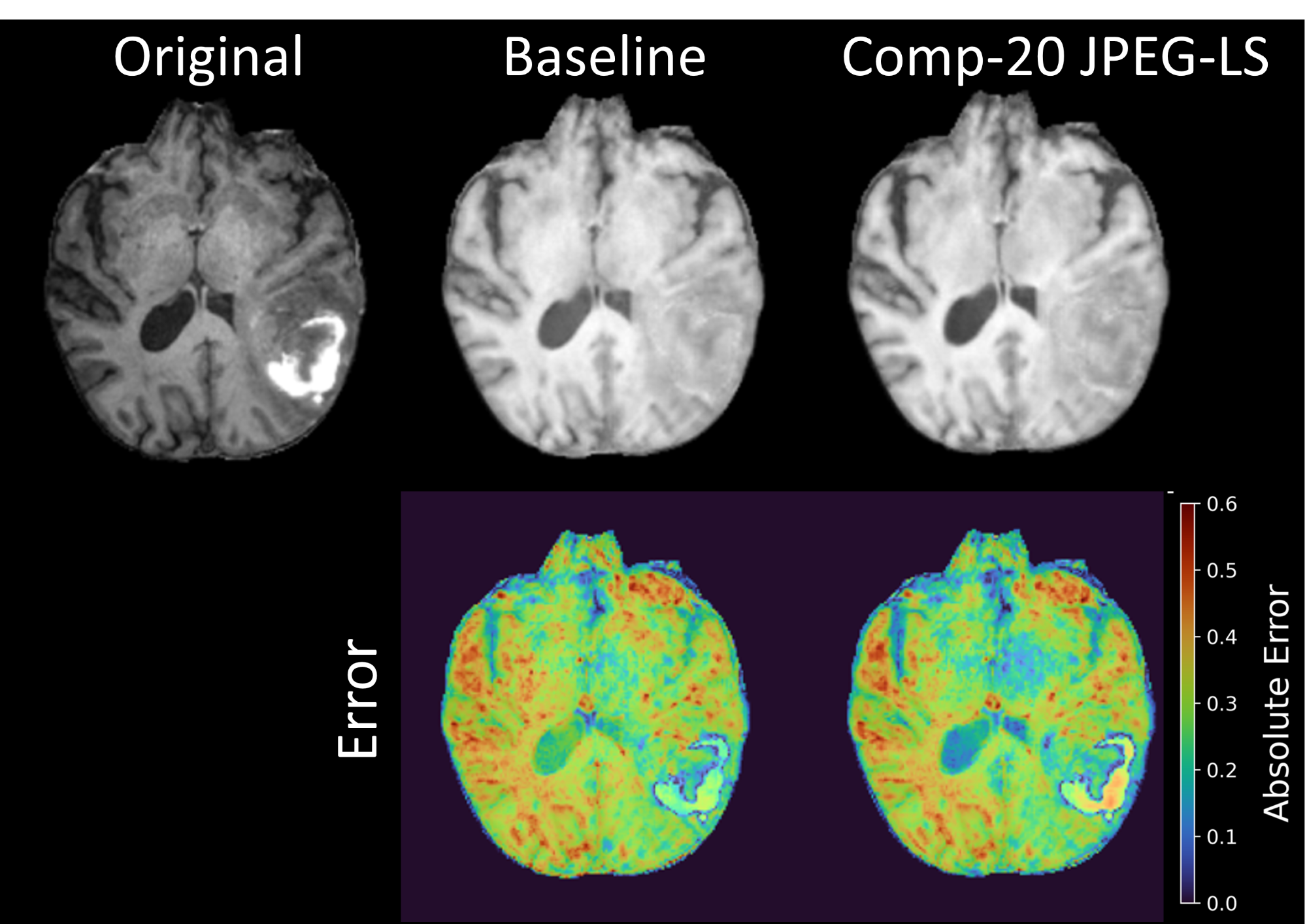 Original, baseline, and JPEG-LS 20:1 synthesis with absolute-error maps.