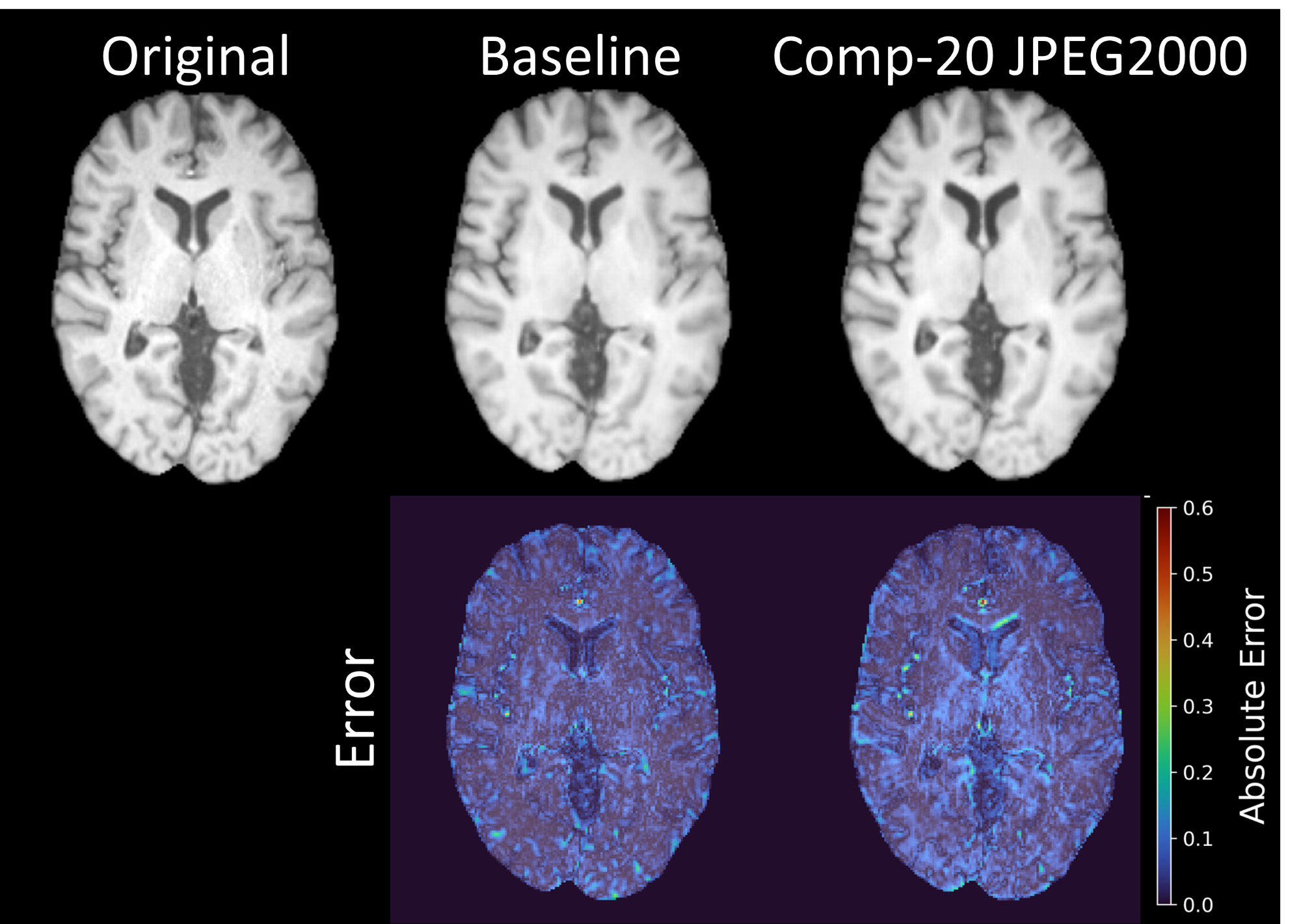 Original, baseline, and JPEG2000 20:1 synthesis with absolute-error maps.